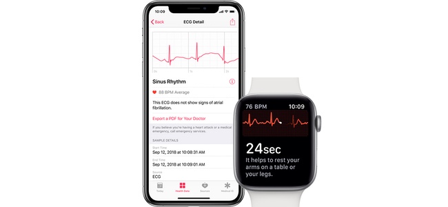 watchOS 5.1.2でApple Watch Series 4の心電図測定機能が有効になる模様